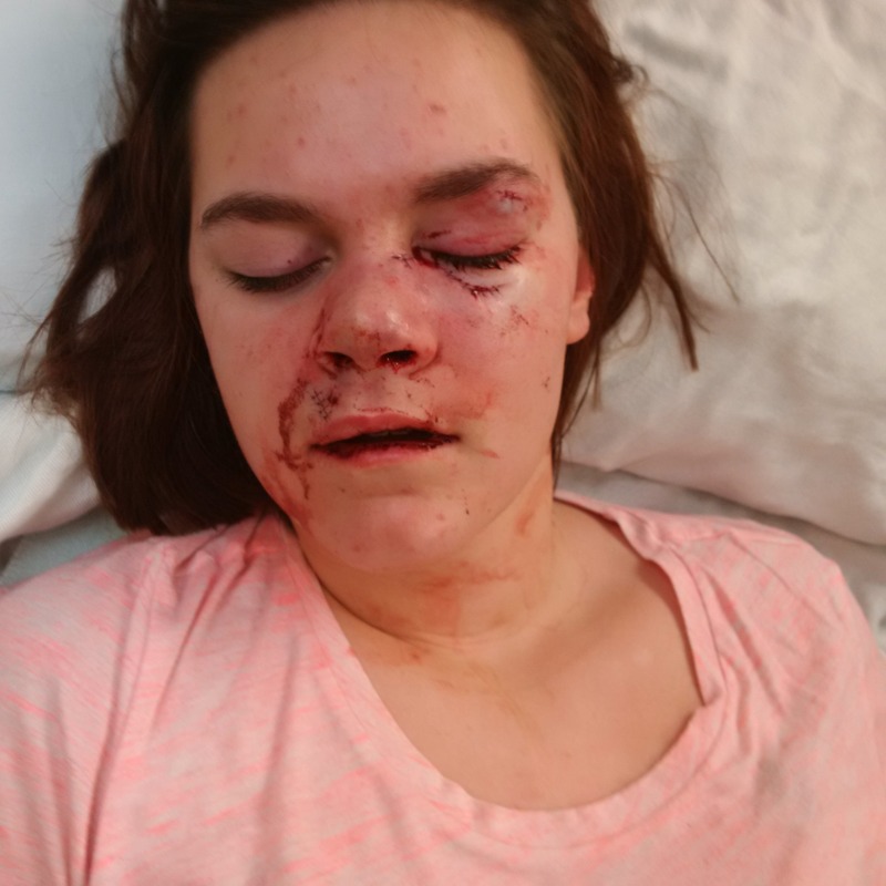 Name:  Nov%2024%20just%20finished%20at%20hospital_zps1oqicxox.jpg
Views: 98
Size:  96.2 KB