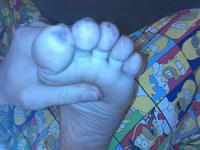 What the heck is this on my toes?-0111082137.jpg