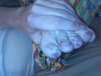 What the heck is this on my toes?-0111082137a.jpg