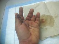 What happens when you fight a table saw.-image-3420566409.jpg